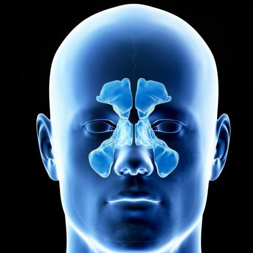 chronic sinus